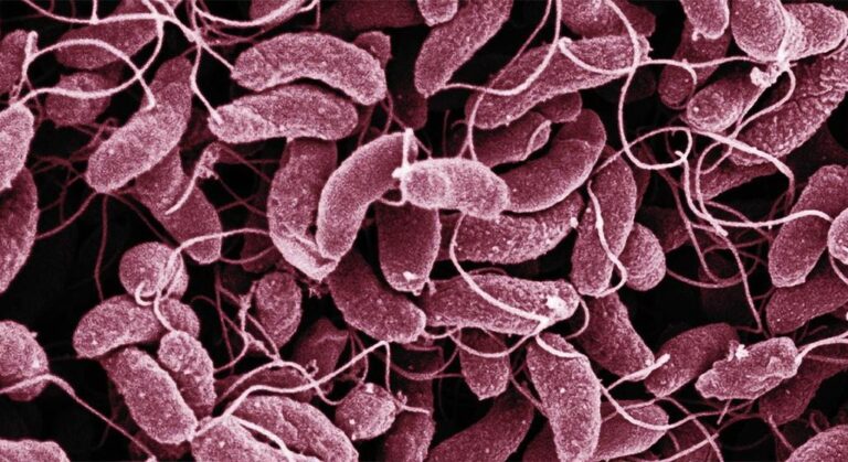 Cholera, Not Poisoned Rice, Behind Badagry Deaths – Health Officials