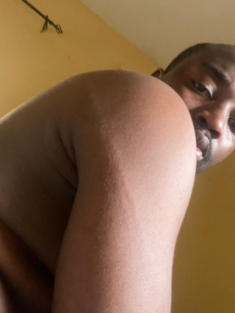 Victim of Police Brutality Cries for Justice After Beating in Abuja