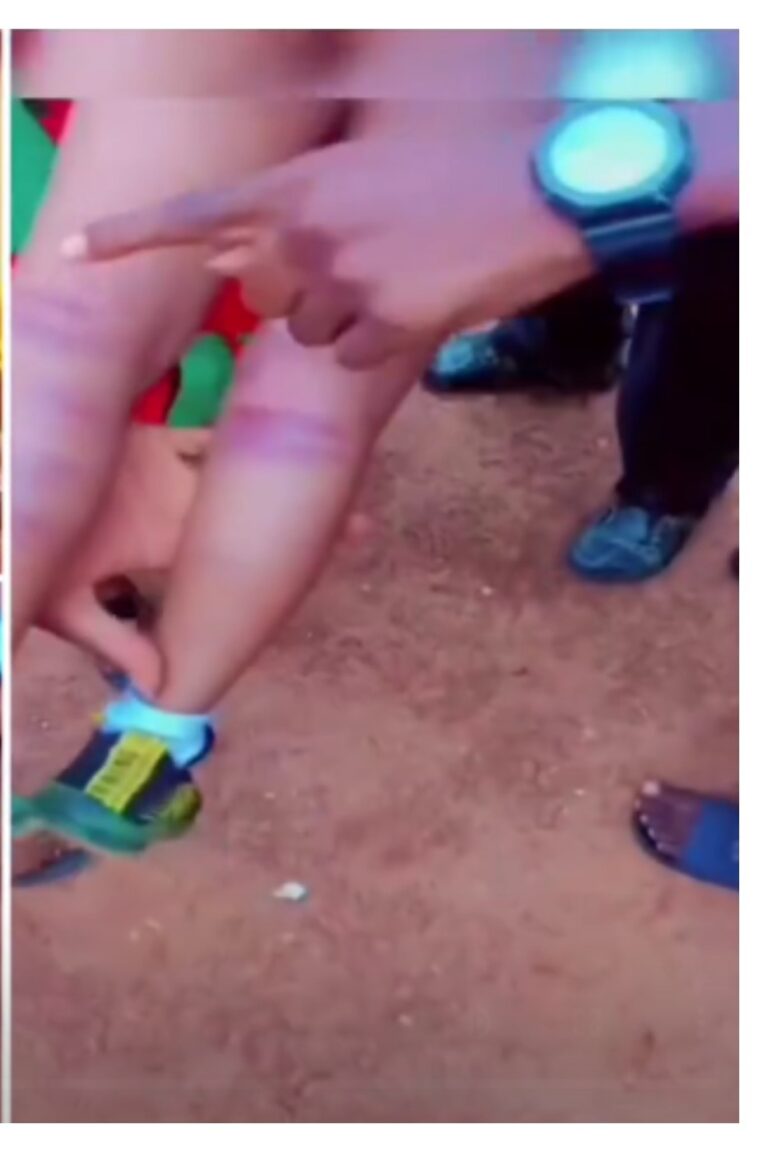 Outrage as Teacher Allegedly Brutalizes Pupil in Enugu