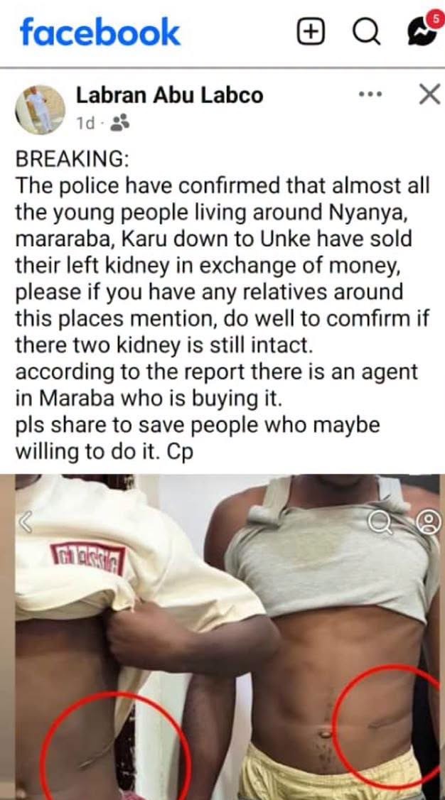 FCT Police Debunks Kidney Trafficking Claim