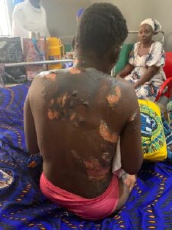 Kogi Police Arrest Man Over Wife’s Attack